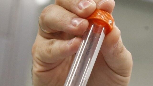 Diabet xəstələrinə MÜJDƏ: Bu vitamin yaddaşı qoruya bilər